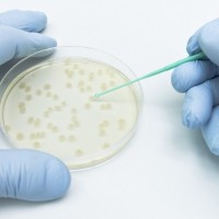 Inoculating Loops