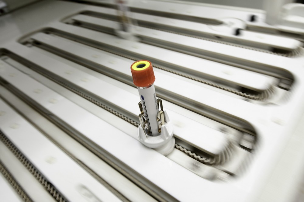 Custom Laboratory Automation